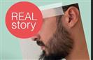 Beard Transplantation - Turkeyana Clinic