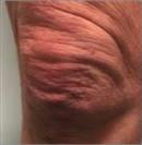D.A.S. Medical - Skin Laxity - Turkeyana Clinic