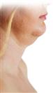 Chin Reduction - Turkeyana Clinic