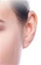 Ear Plastic Surgery - Turkeyana Clinic