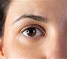 Eyelid Surgery - Turkeyana Clinic