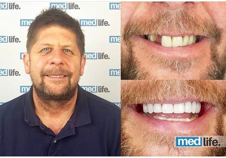 Dental - Medlife Group