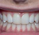 Orthodontics - Uzmanlar Oral and Dental Health Clinic