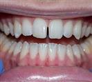 Orthodontics - Uzmanlar Oral and Dental Health Clinic