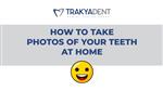 How To Take Dental Photos