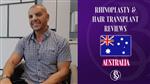 Patient Review for Rhinoplasty & Hair Transplant at Dr. Salih Onur Basat