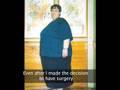 MD Marco Moore - Gastric bypass Surgery 3